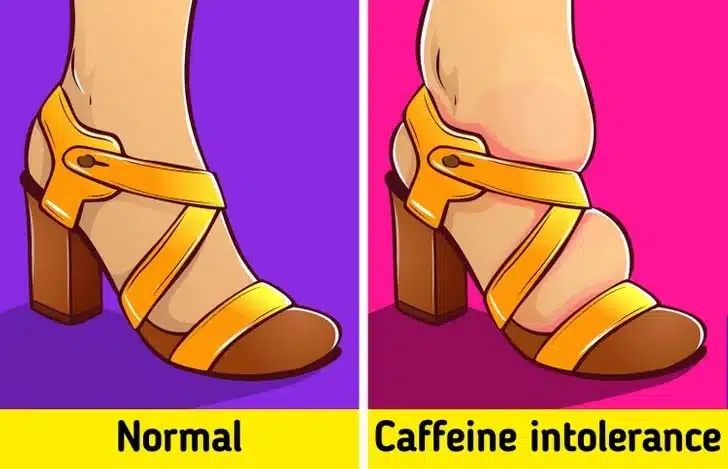 Gonflements liés à la caféine