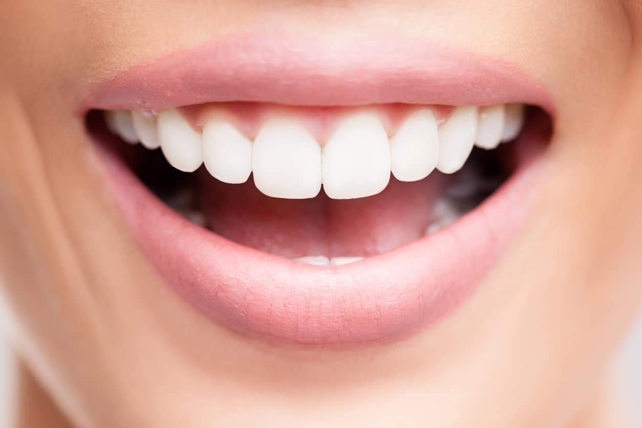 Sourire éclatant