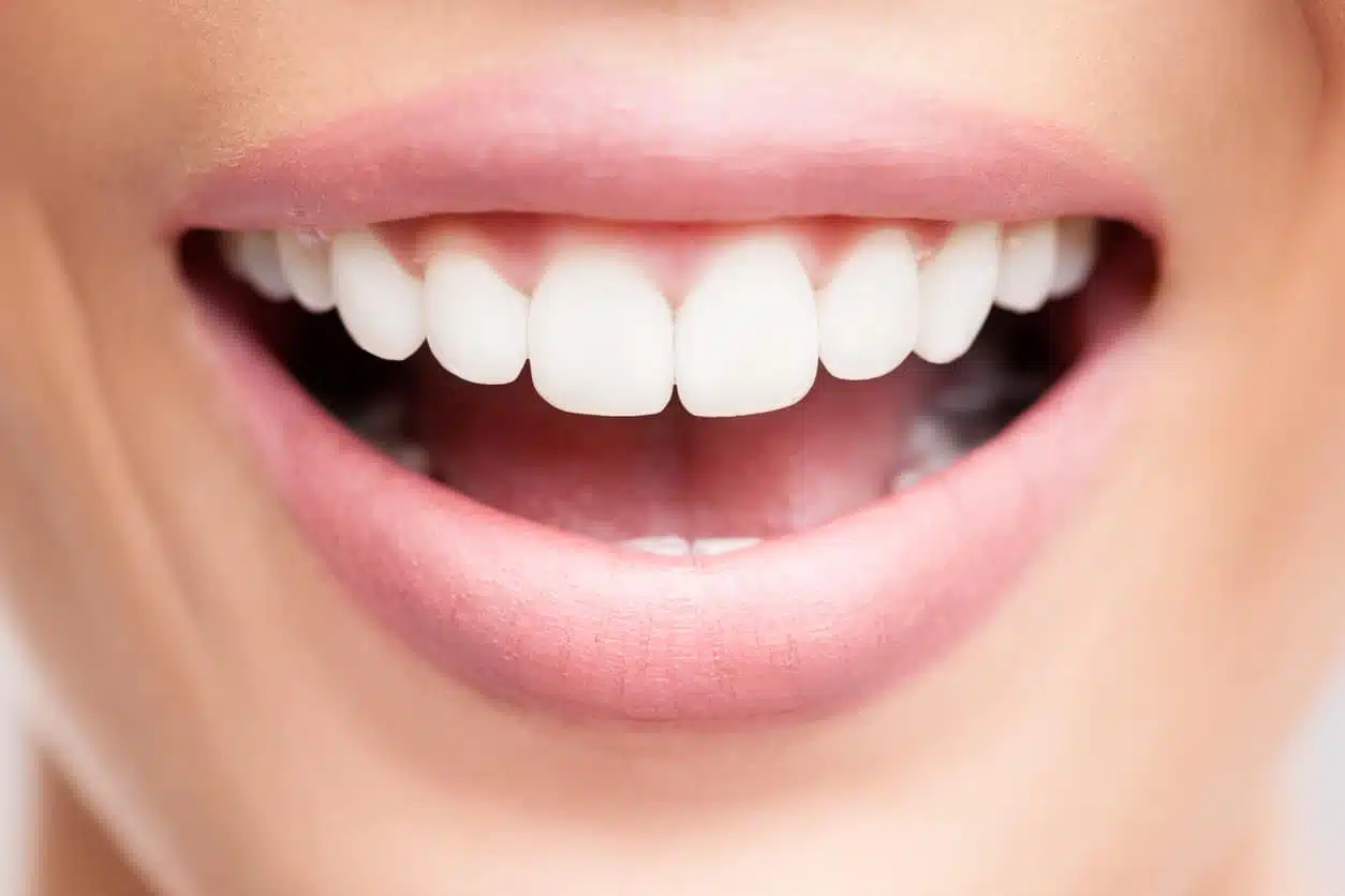 Sourire éclatant