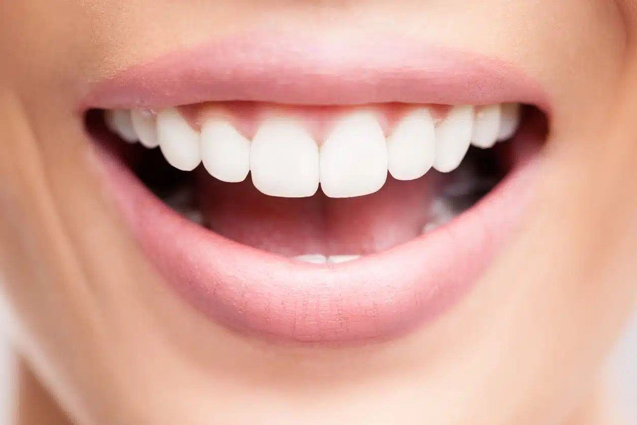 Illustration d’un sourire éclatant