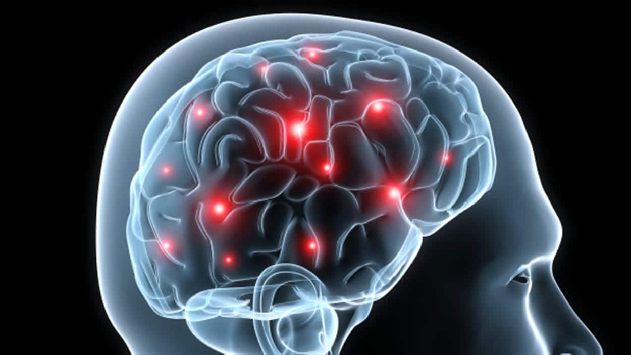 Illustration d'une activit&eacute; c&eacute;r&eacute;brale montrant les raccourcis mentaux