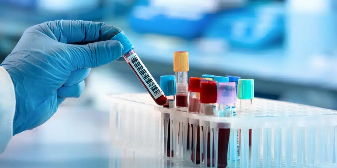 Analyse de sang au microscope