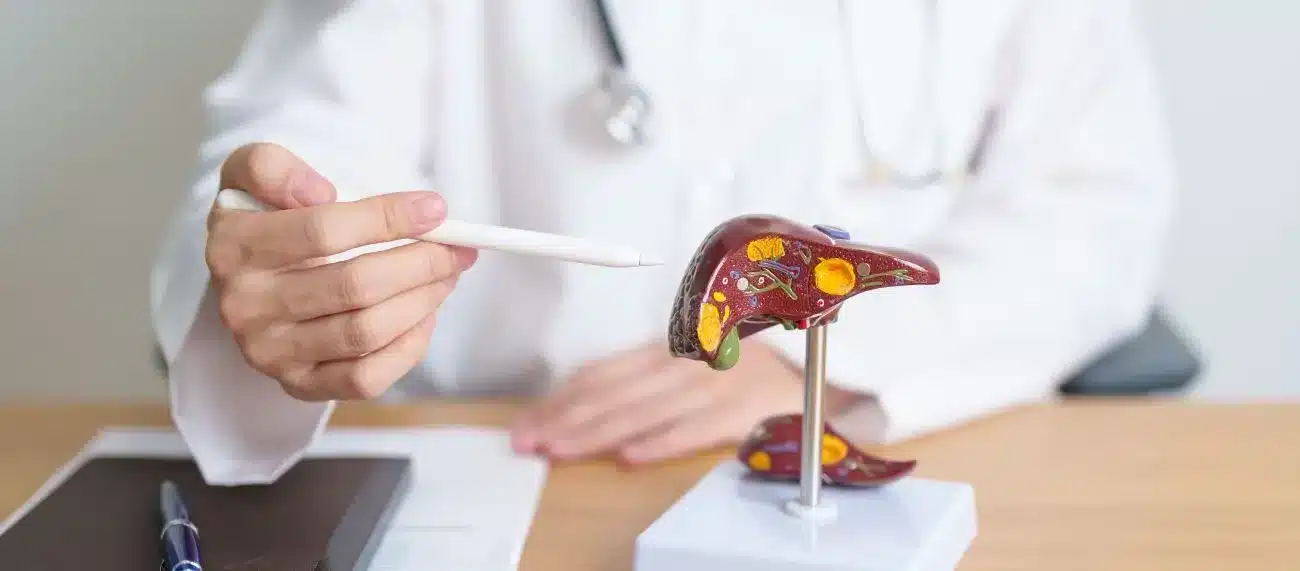 Foie en bonne santé vs foie atteint de stéatose
