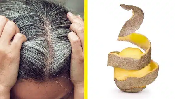 Remède naturel pour cheveux blancs