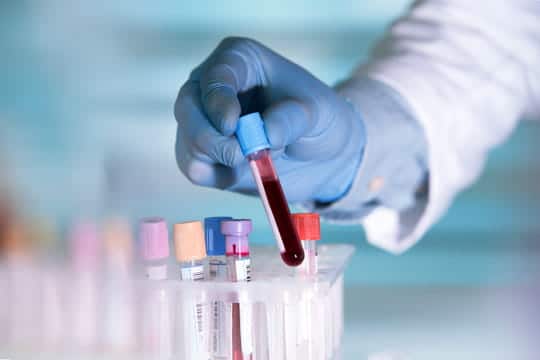 Test ADN en laboratoire