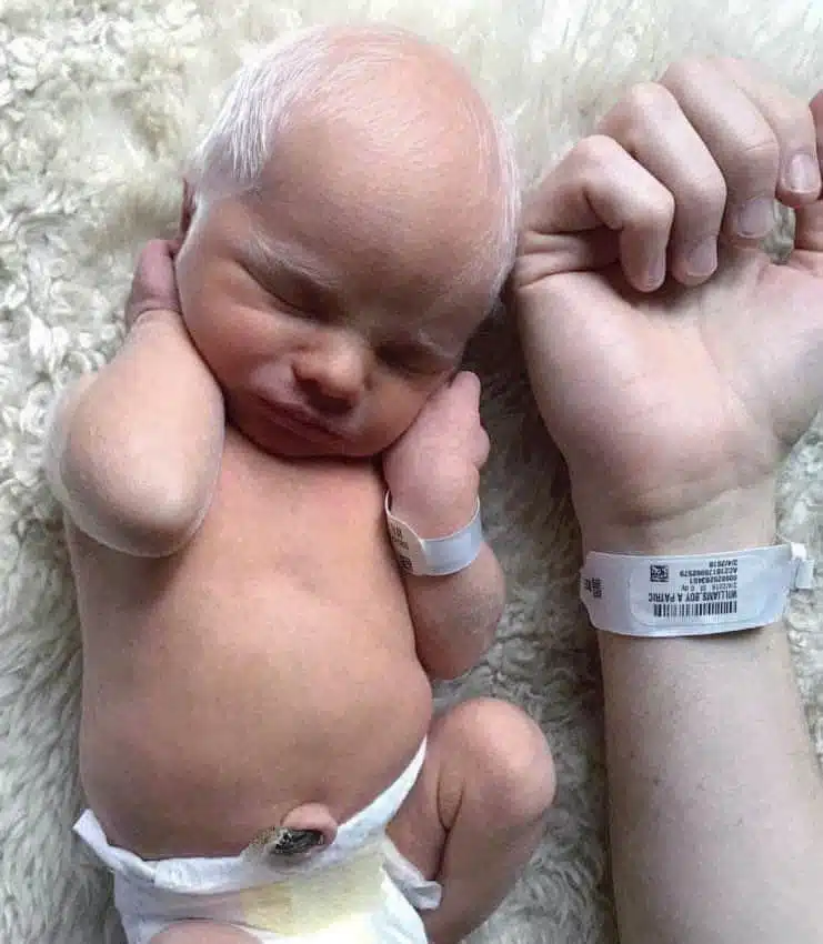 Redd, enfant albinos aux cheveux blancs et aux yeux bleus intenses