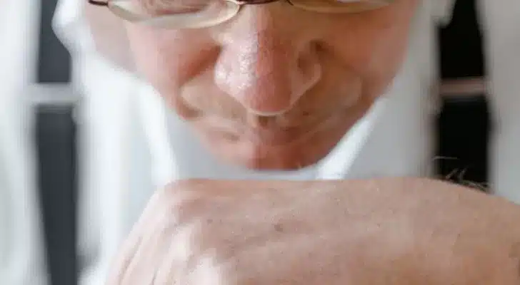 Visuel illustrant le vieillissement cutané