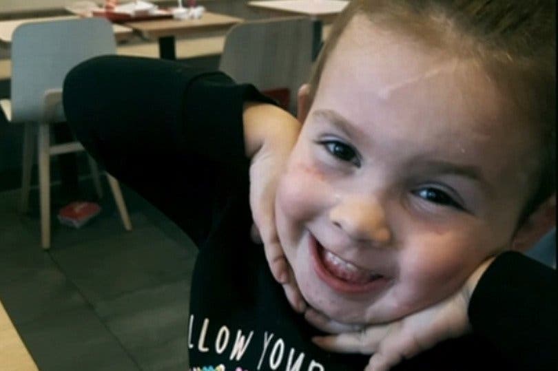 Pitbulls attaquent sauvagement une petite fille de 2 ans sans défenses