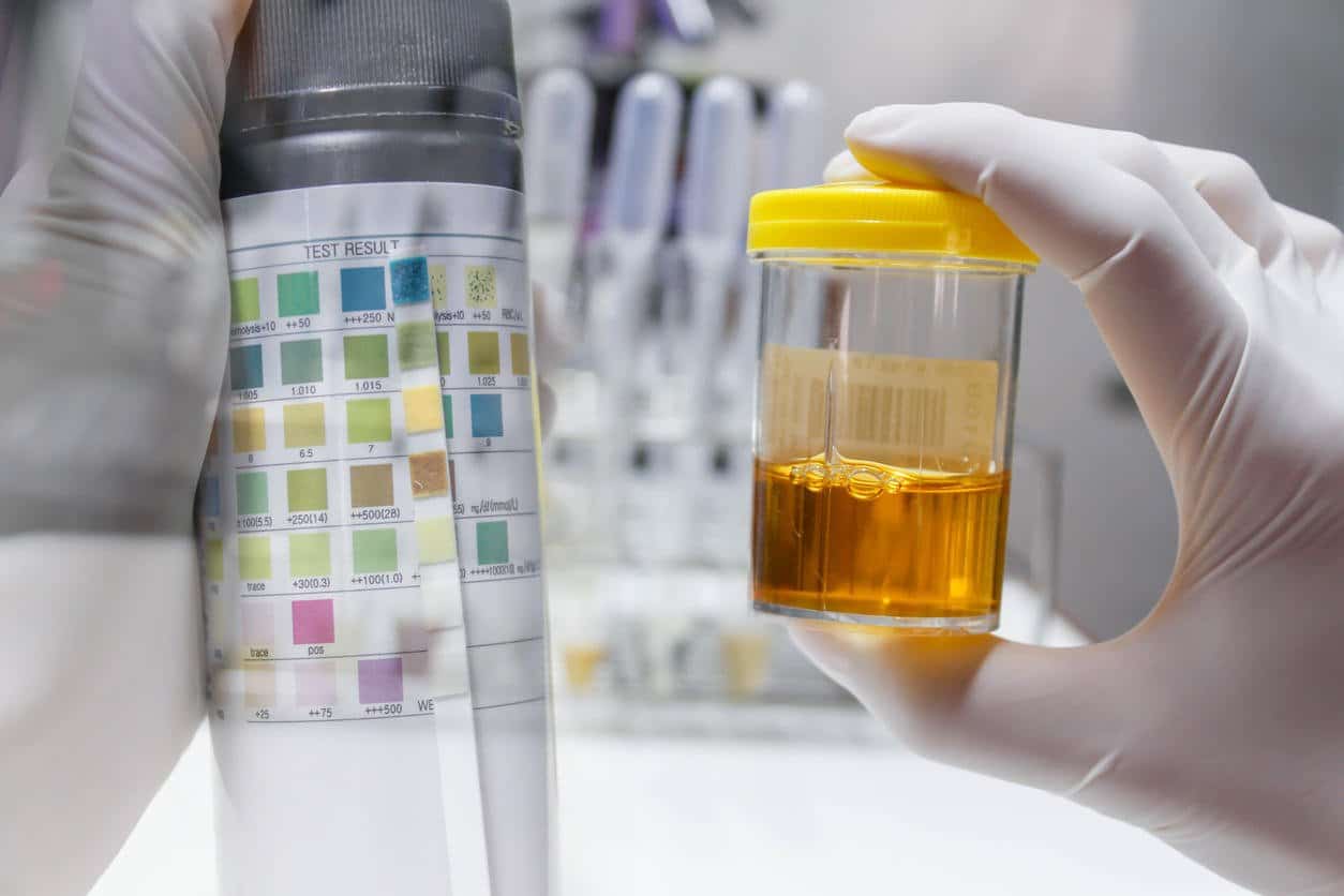 Illustration d'urine orange