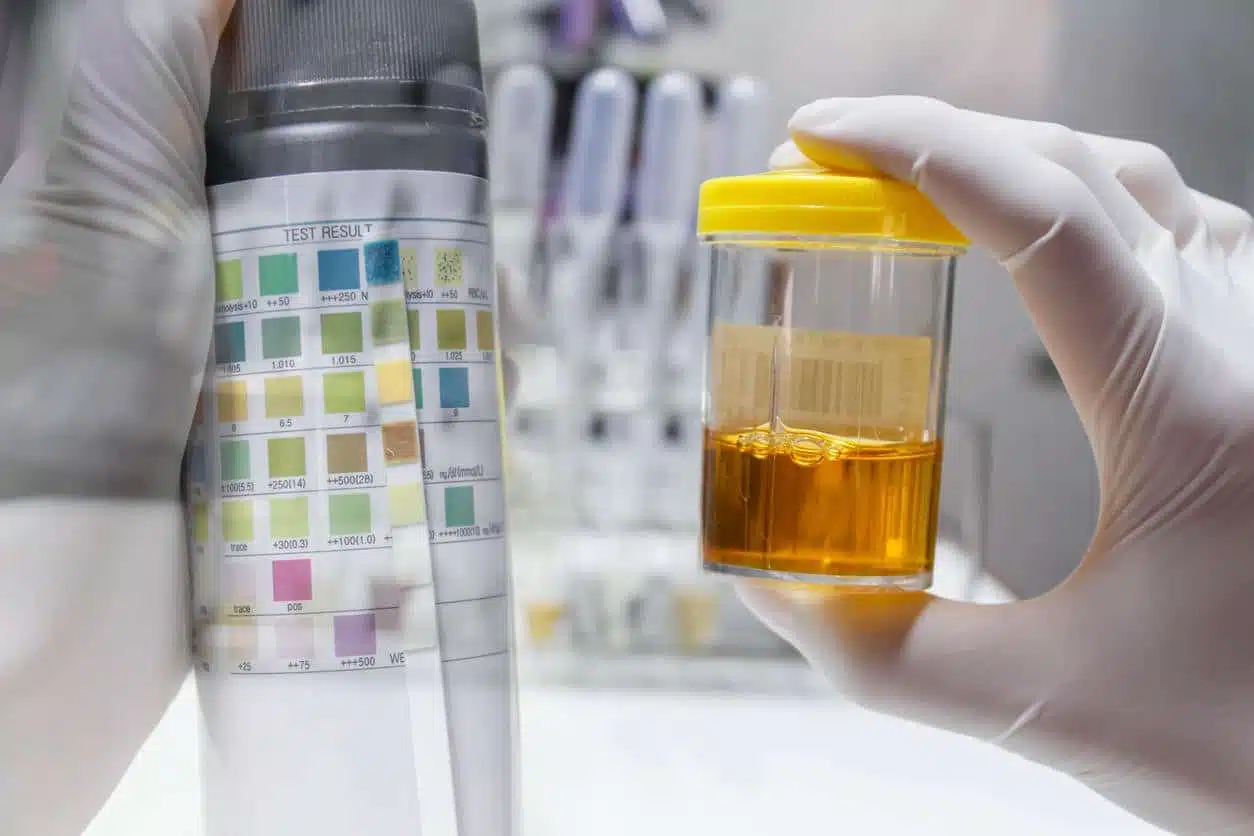Illustration d'urine orange
