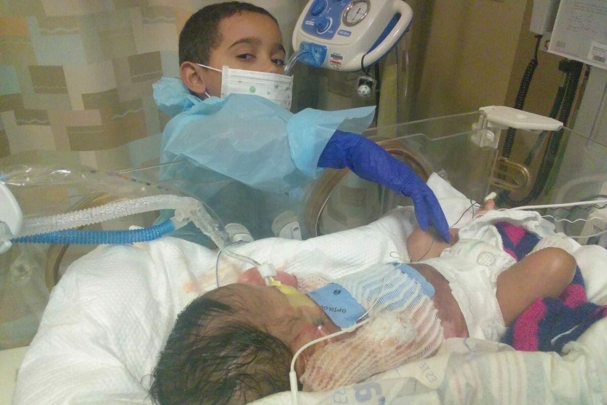 Ce bébé né sans peau se prépare pour une importante opération chirurgicale