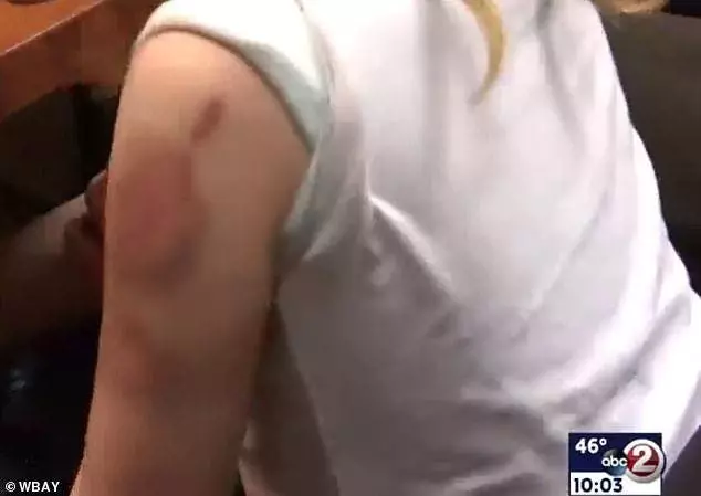 Ces parents étaient furieux lorsqu’ils ont appris que leur fille handicapée a été mordue dans l’autobus scolaire