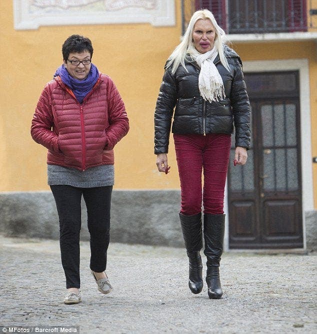 Cette femme a d&eacute;pens&eacute; 46 000 euros en chirurgie pour avoir un visage parfait