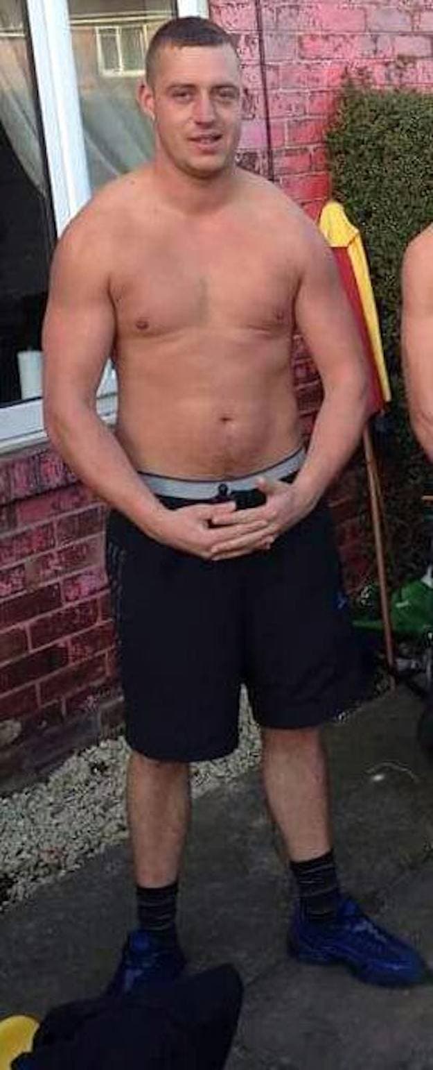 Cette femme a &eacute;t&eacute; battu par son petit ami et publie des photos pour d&eacute;noncer la violence contre les femmes