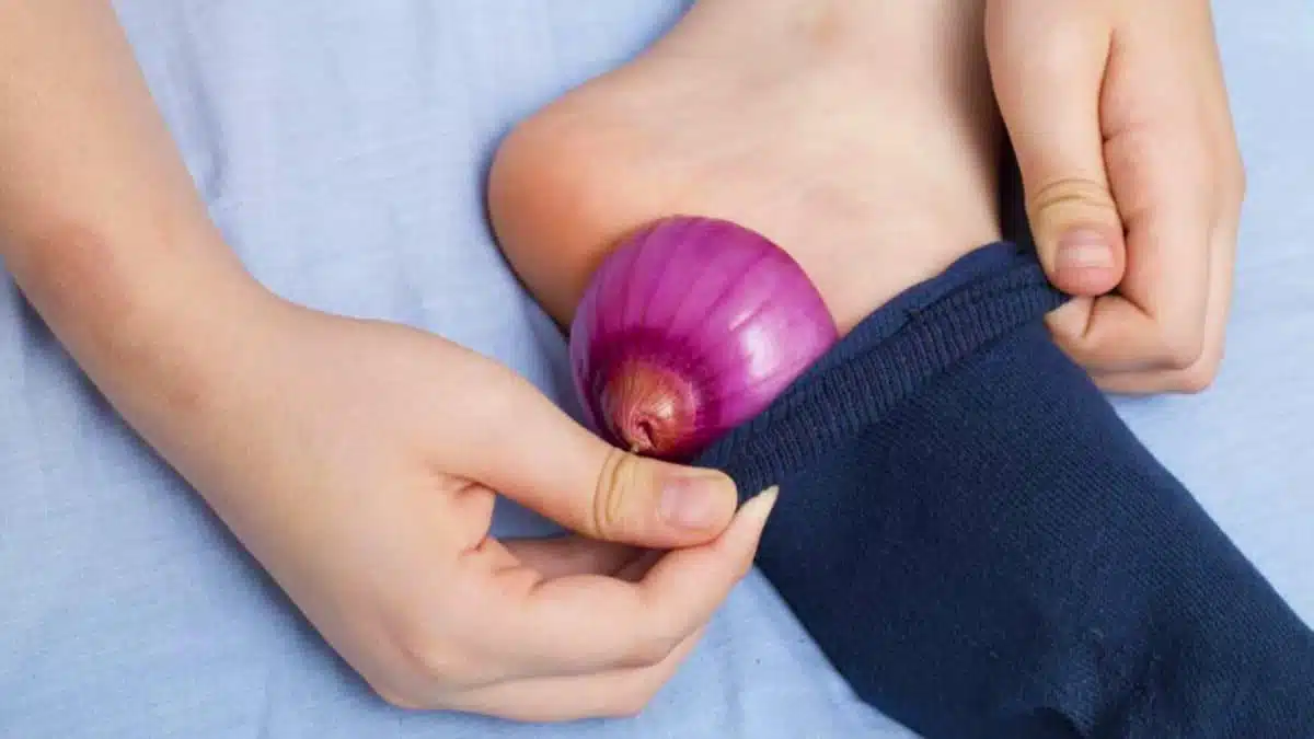 Tranches d'oignon placées dans des chaussettes pour une détox nocturne