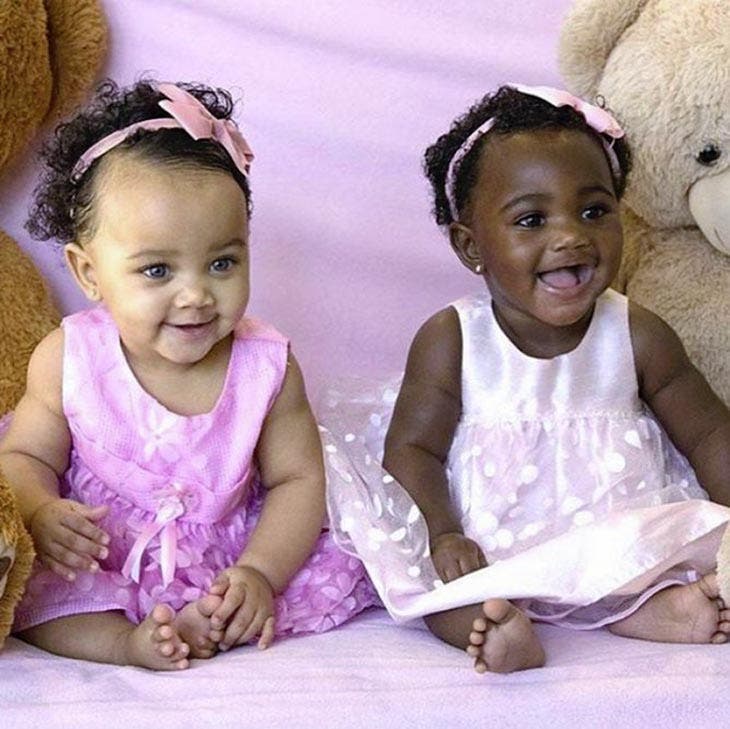 Les deux bébés jumeaux. source : spm