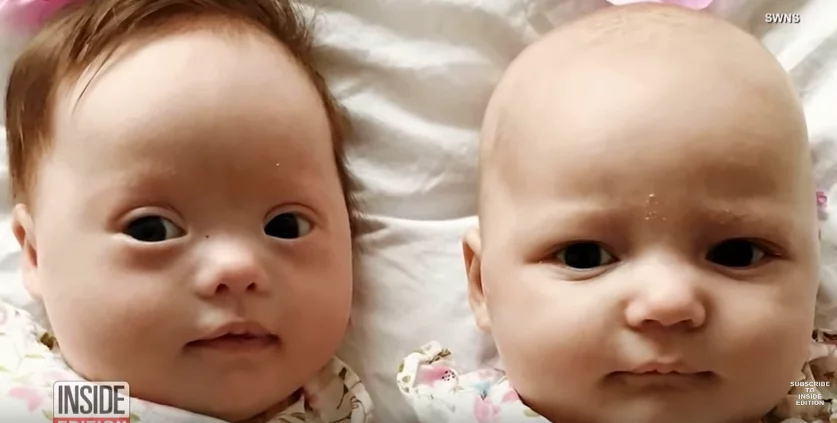 Les jumelles de cette maman sont nées prématurément mais le médecins affirme qu’il est désolé