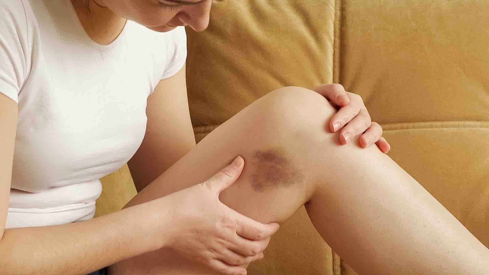 Teinte bleutée sur les doigts indiquant un possible trouble circulatoire