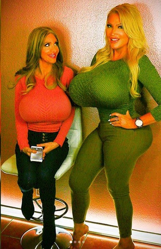 Cette femme est devenue c&eacute;l&egrave;bre sur les r&eacute;seaux sociaux gr&acirc;ce &agrave; ses seins de 10 kilos