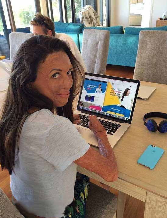 Turia Pitt