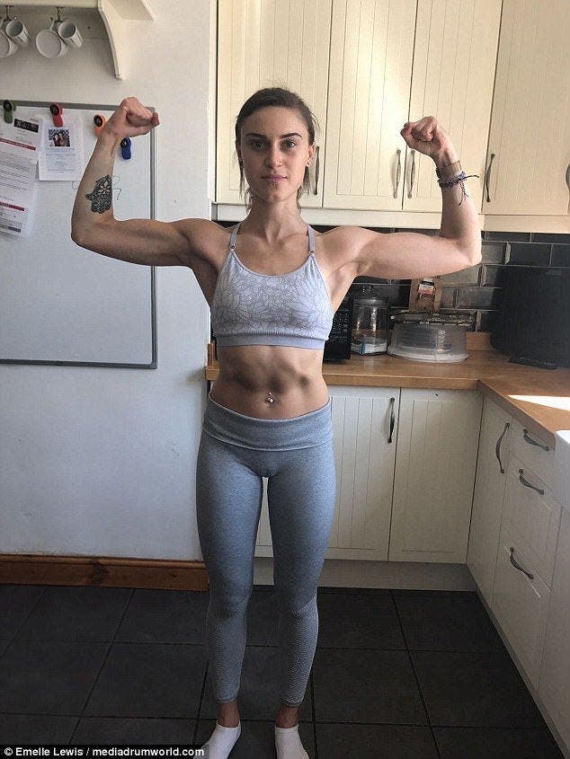 Une jeune fille anorexique montre des photos avant et apr&egrave;s sa gu&eacute;rison et elle est devenue tr&egrave;s jolie