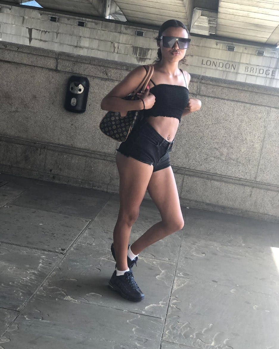 Une maman veut que sa fille de 14 ans fasse de la chirurgie esthétique