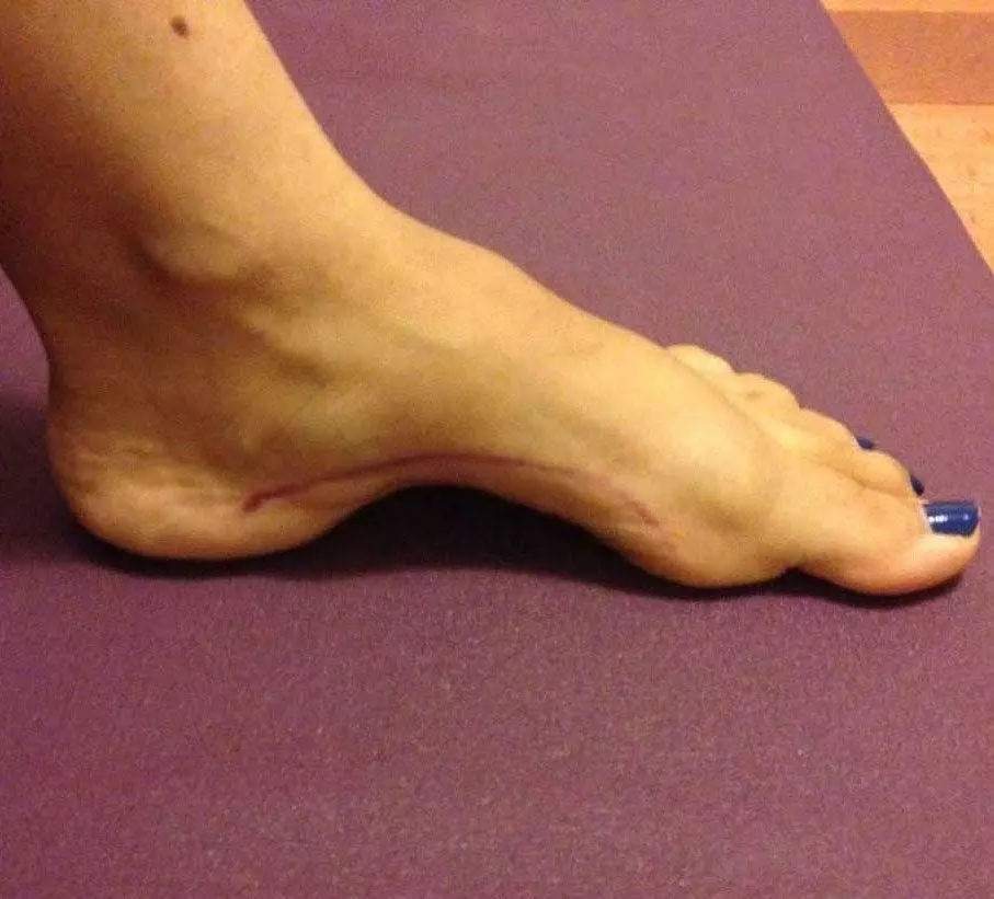 Vos pieds révèlent beaucoup de choses sur votre personnalité