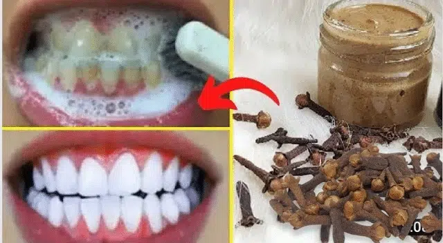 Comparaison avant/après traitement