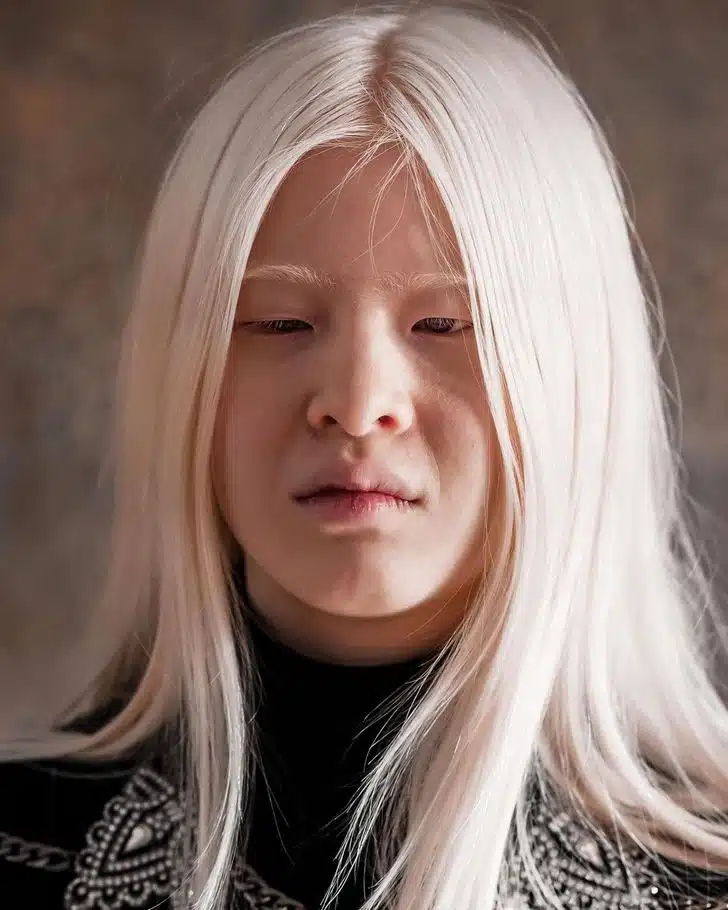Xueli enfant, souriante avec ses cheveux blancs