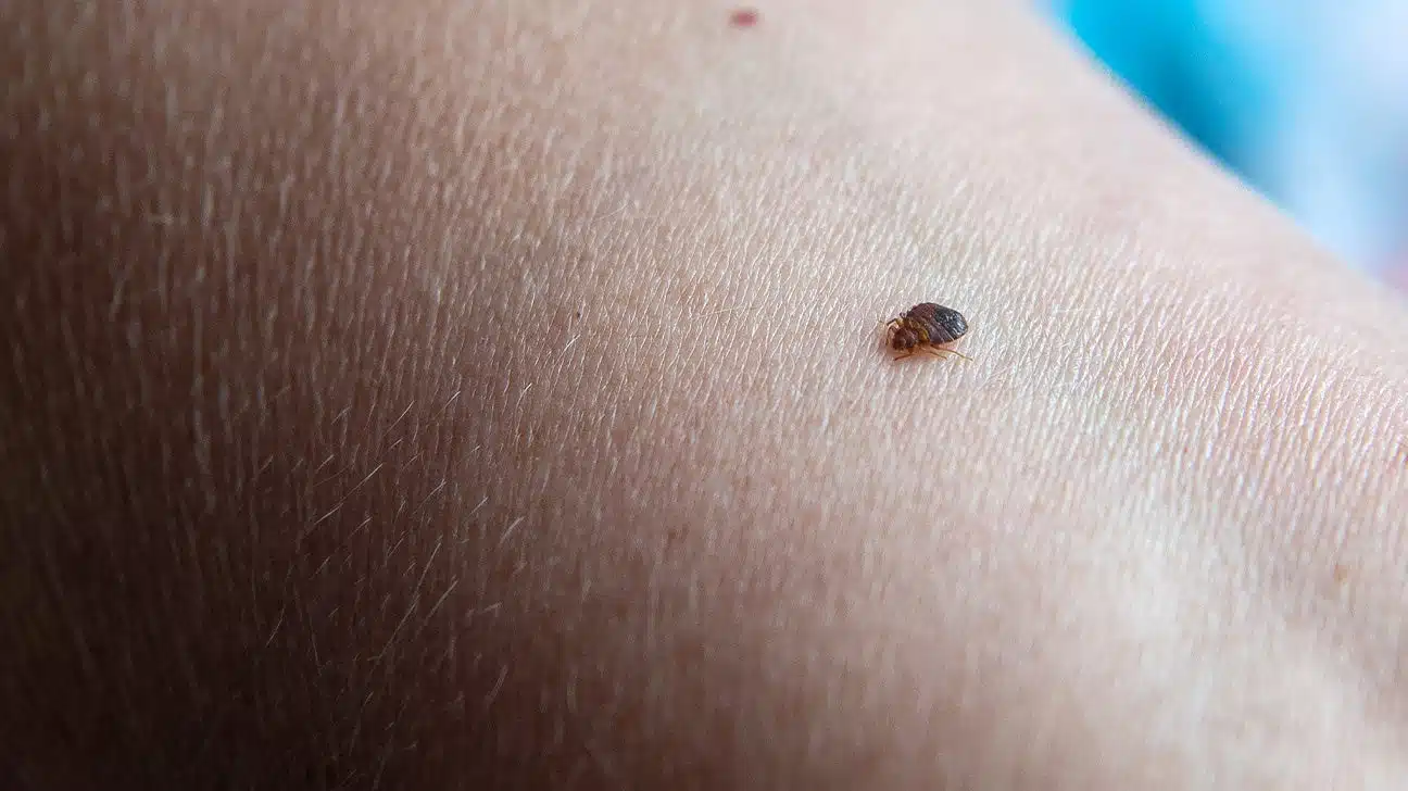 Piqures de punaises de lit sur bras humain