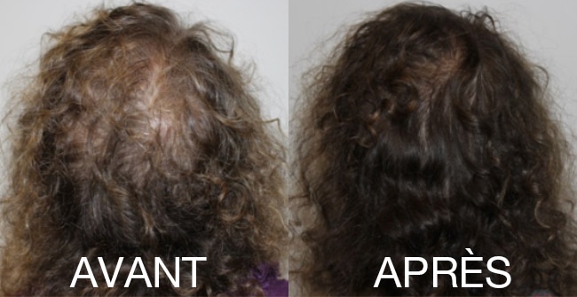 Comparaison visuelle de l'aspect des cheveux avant et après des soins réguliers