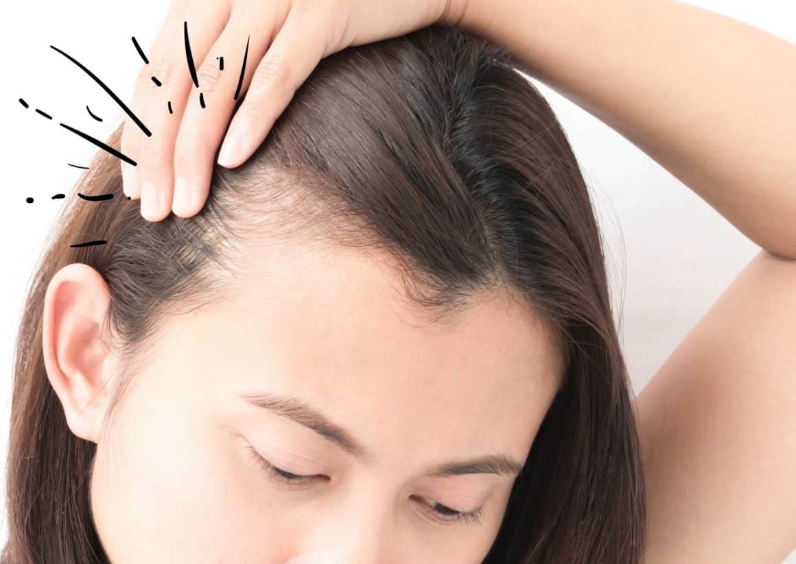 Femme aux cheveux fins et ternes