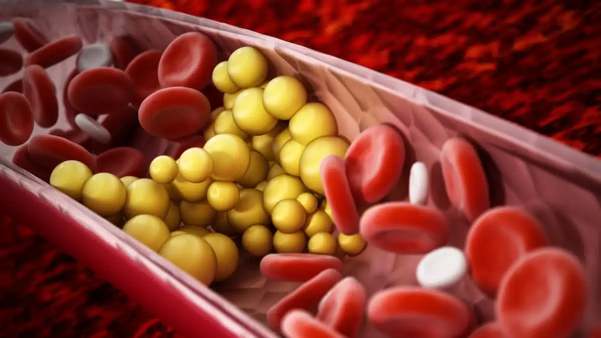 Illustration 3D de cellules graisseuses obstruant une veine