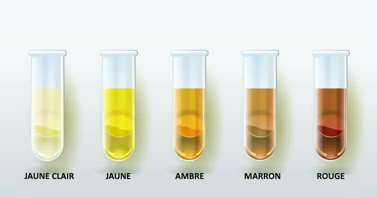 Palette de couleurs urinaires