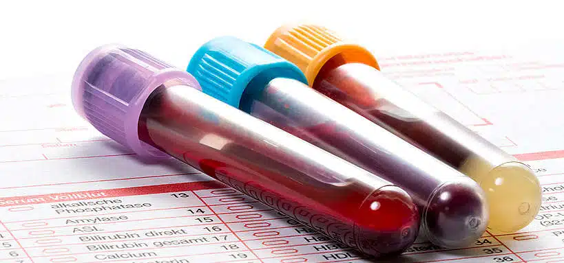 Un tube à essai contenant un échantillon de sang, symbolisant un test ADN ou génétique