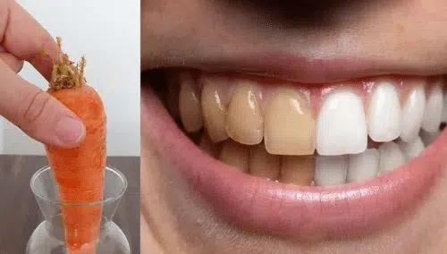 Avantages du blanchiment naturel