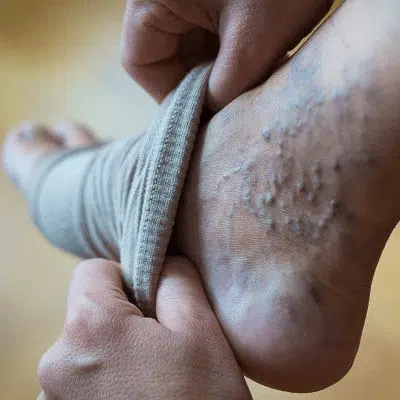 Personne faisant des exercices pour jambes