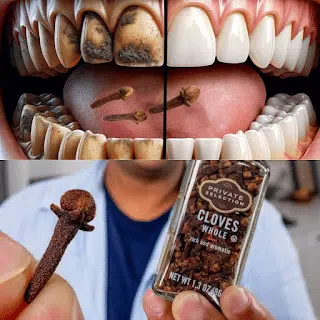 Dentifrice naturel au clou de girofle