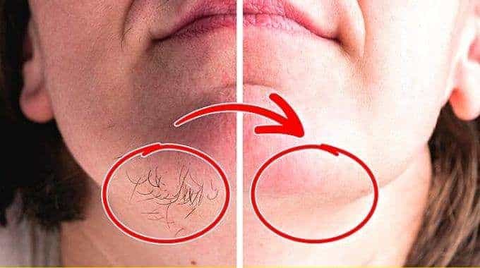 Consultation chez une dermatologue