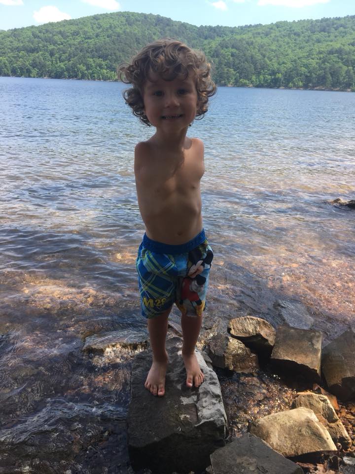 Un gar&ccedil;on de 3 ans sans bras expuls&eacute;