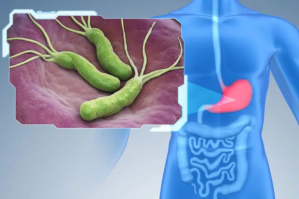 Schéma de la bactérie H. pylori dans l'estomac