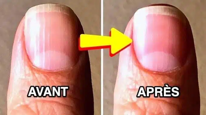 Aliments bons pour les ongles
