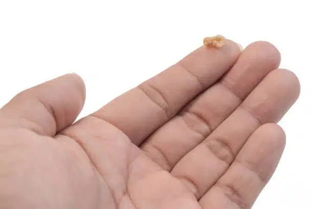 Femme se rinçant la bouche