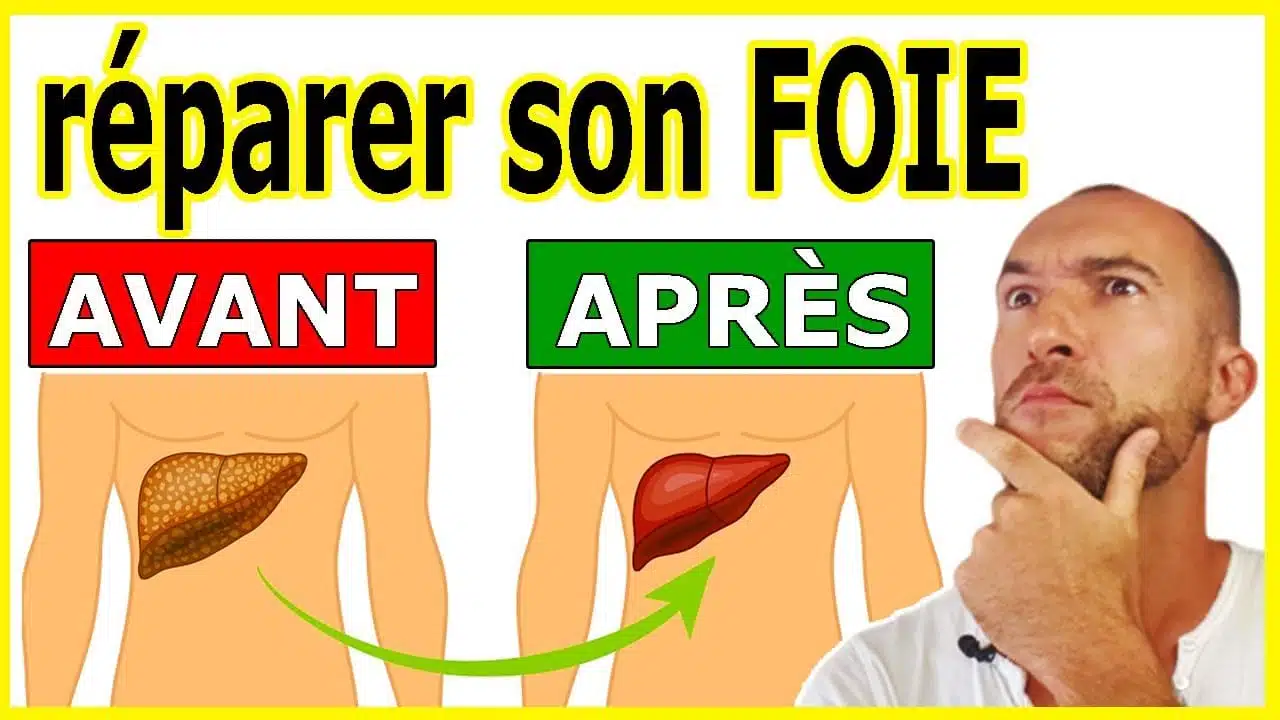 Foie sain vs foie atteint de stéatose