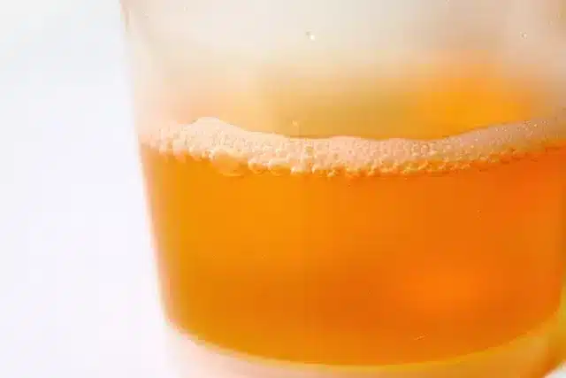 Verre contenant de l'urine mousseuse