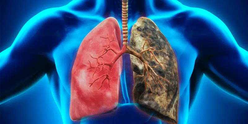 Graphique sur l'évolution des cancers