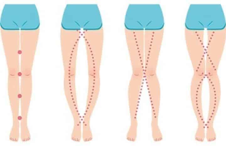 Femme examinant ses jambes