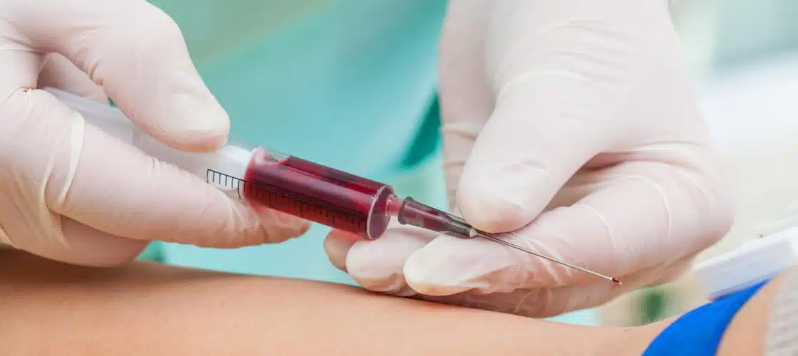 Prélèvements sanguins en laboratoire