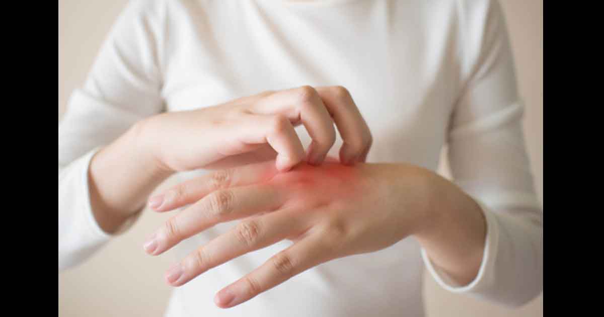 Réaction cutanée aux médicaments