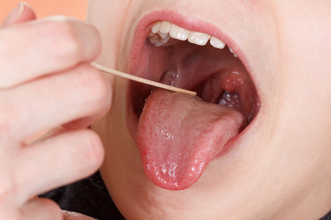 Illustration de soins pour la gorge